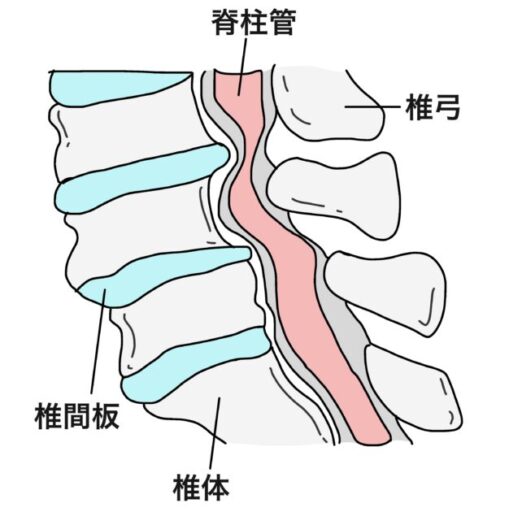 脊柱管狭窄症